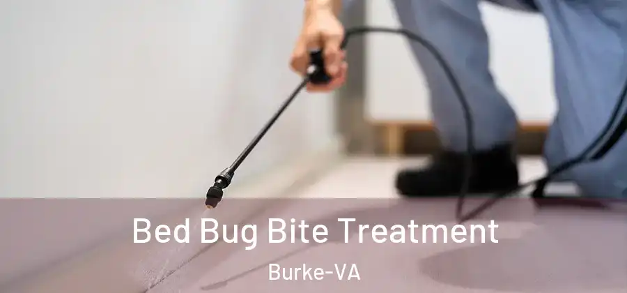 Bed Bug Bite Treatment Burke-VA